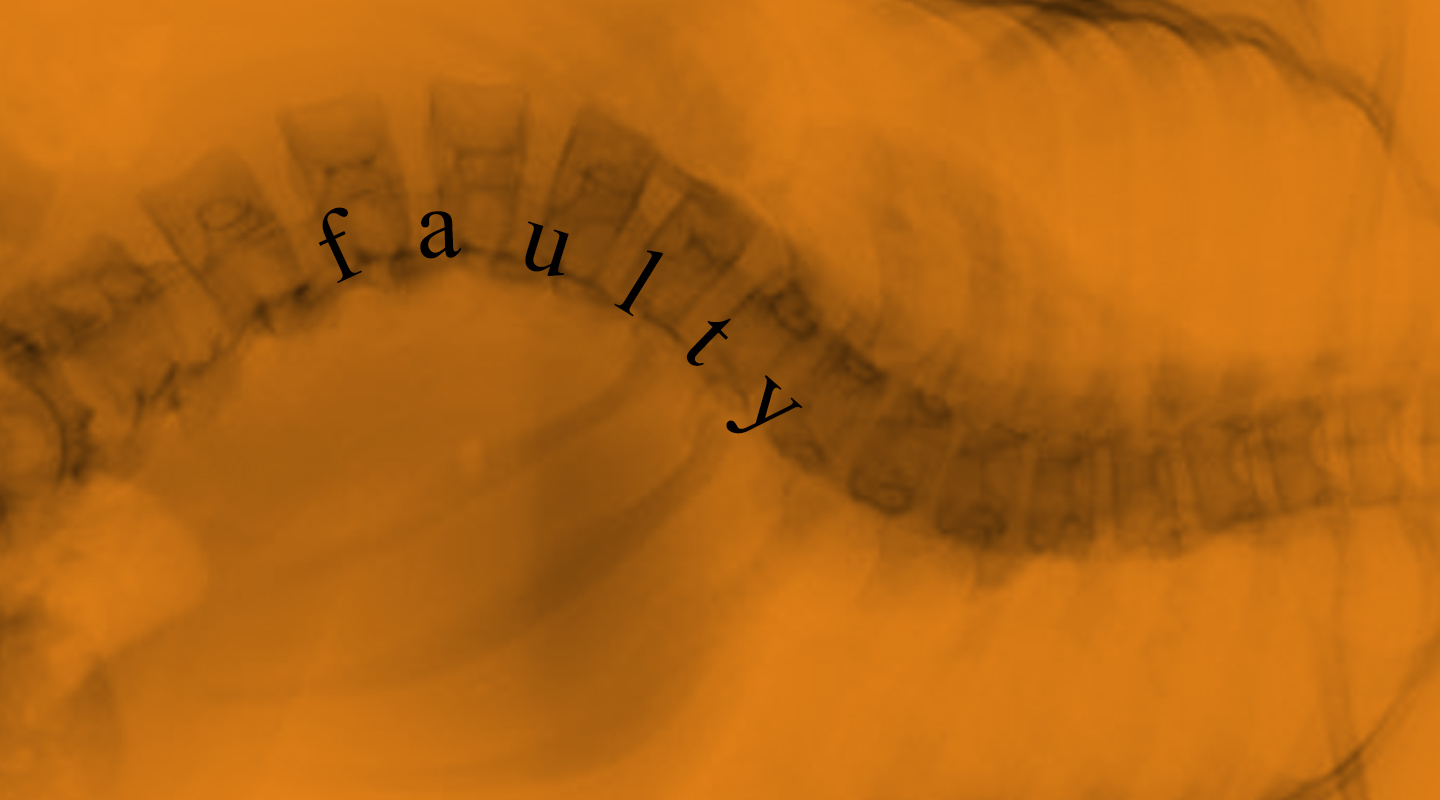 Faulty - scoliosis